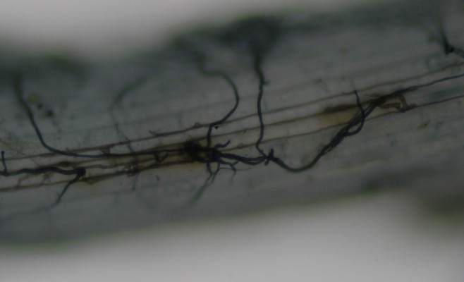 Root Hairs: The First Gateway to Symbiosis